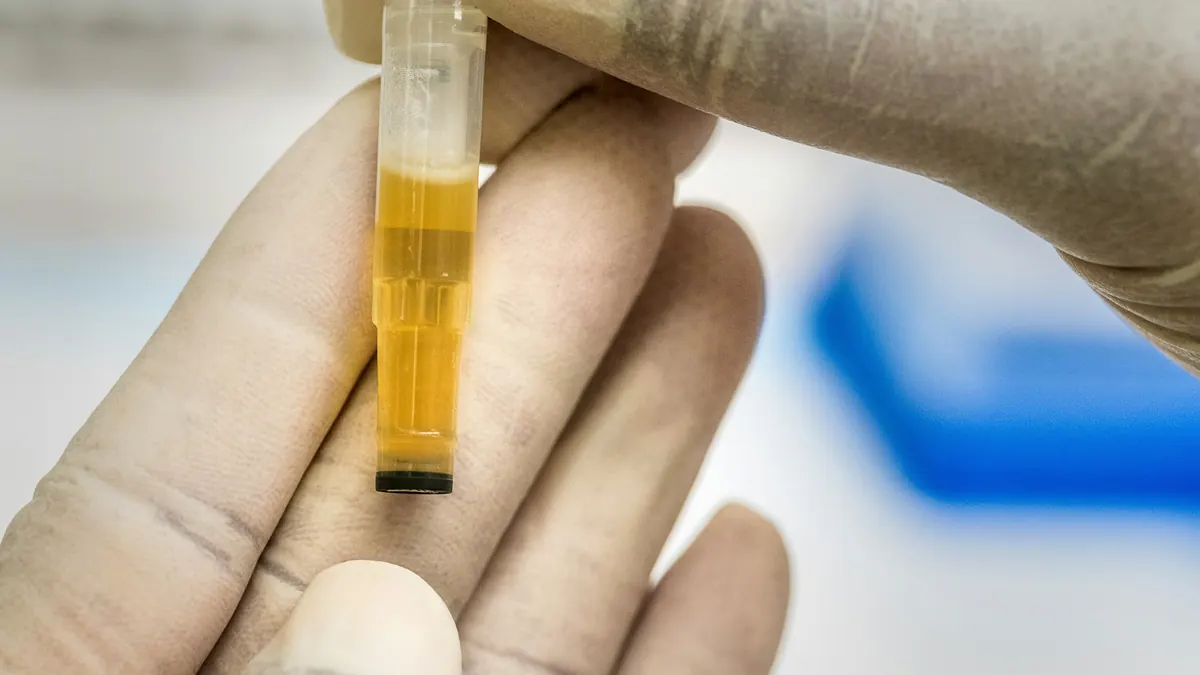 Blood test flags dementia risk a decade before signs